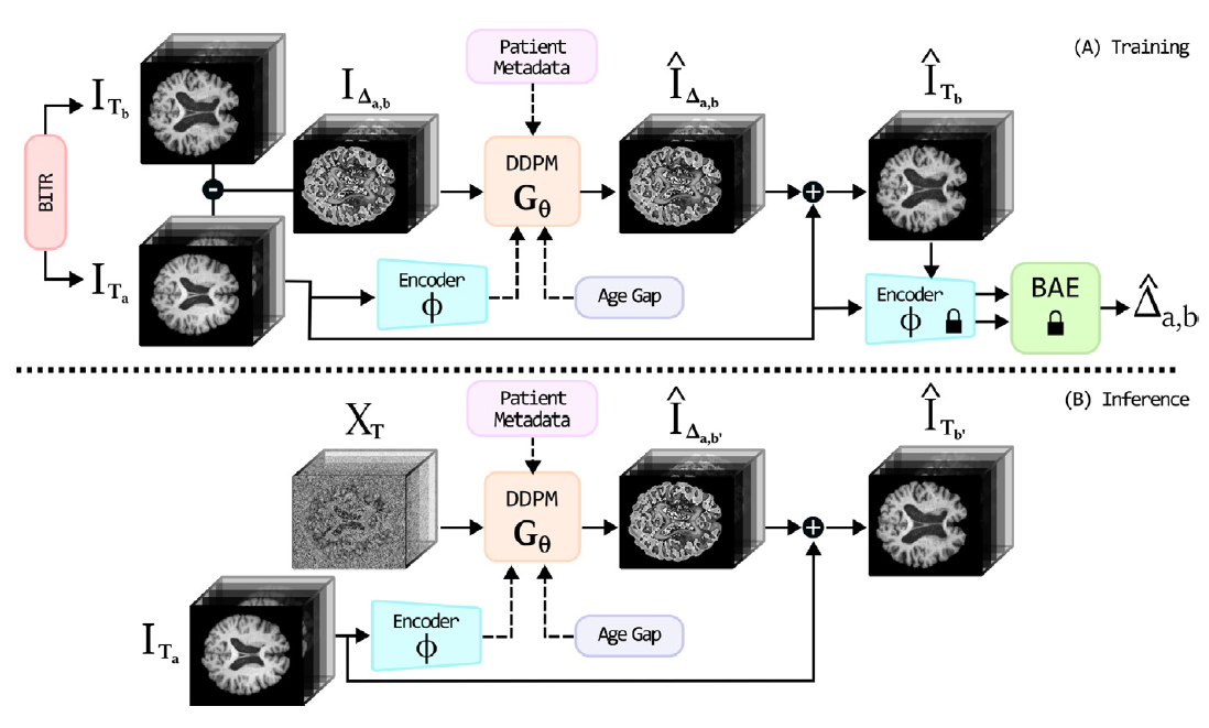 Temporally-aware diffusion model for brain progression modelling